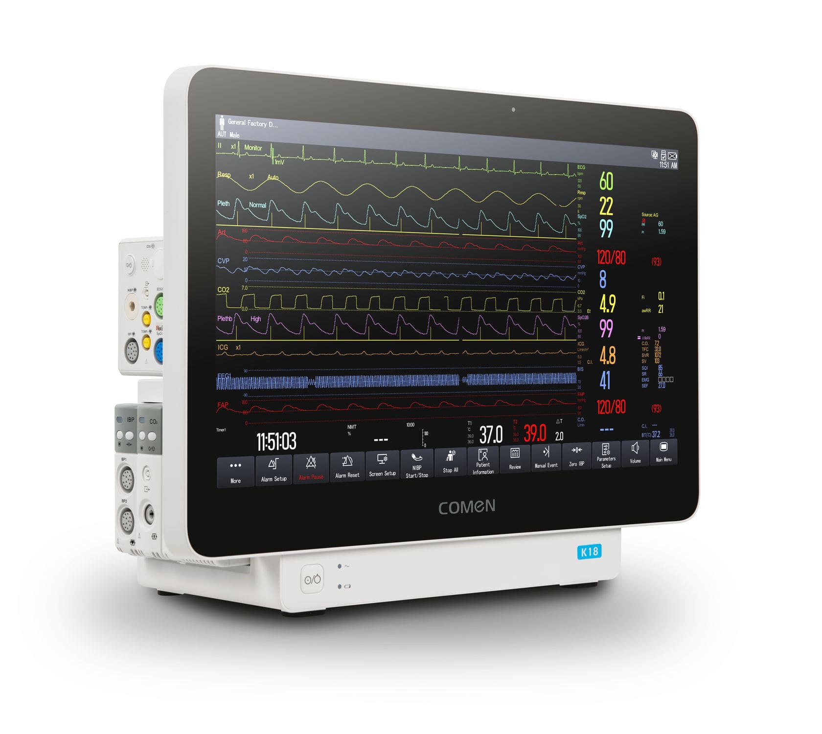 Patient Monitor